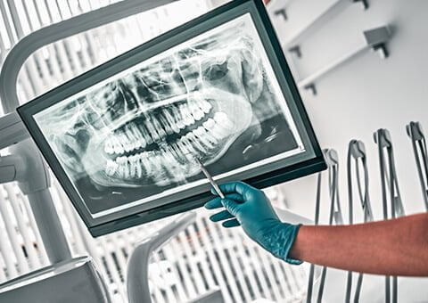 Zirkonyum 2 Dent Implant